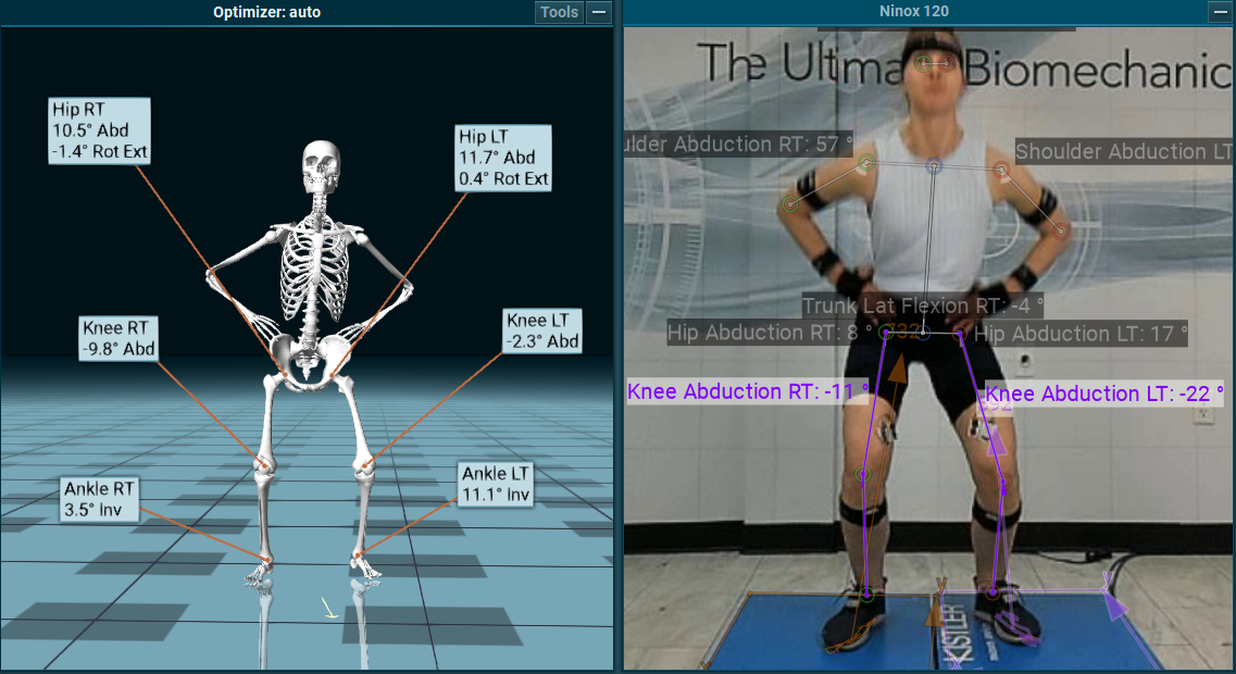 Knee Valgus jump