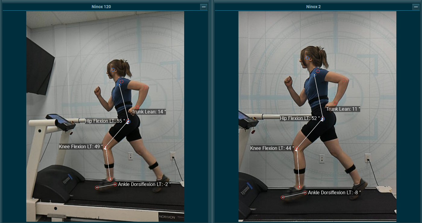 Parallax treadmill Diagram of the Timed Up and Go (TUG) test showing the sequence of movements: sit-to-stand, walking 3 meters (10 feet), turning around, walking back, turning again, and returning to a seated position. Each phase is labeled: Sit-to-Stand, Walk 1, Turn 1, Walk 2, Turn 2, and Stand-to-Sit.