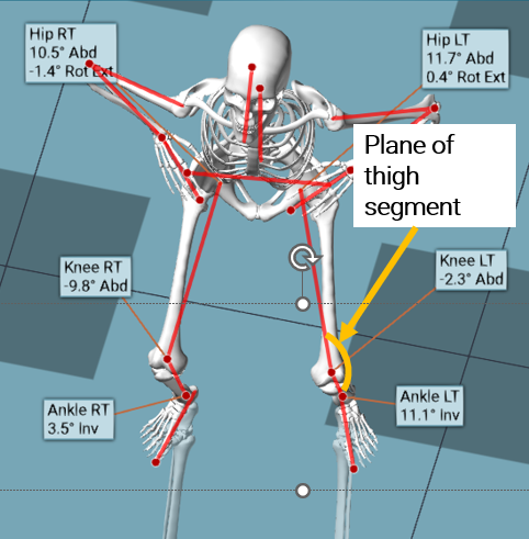 Thigh segment plane