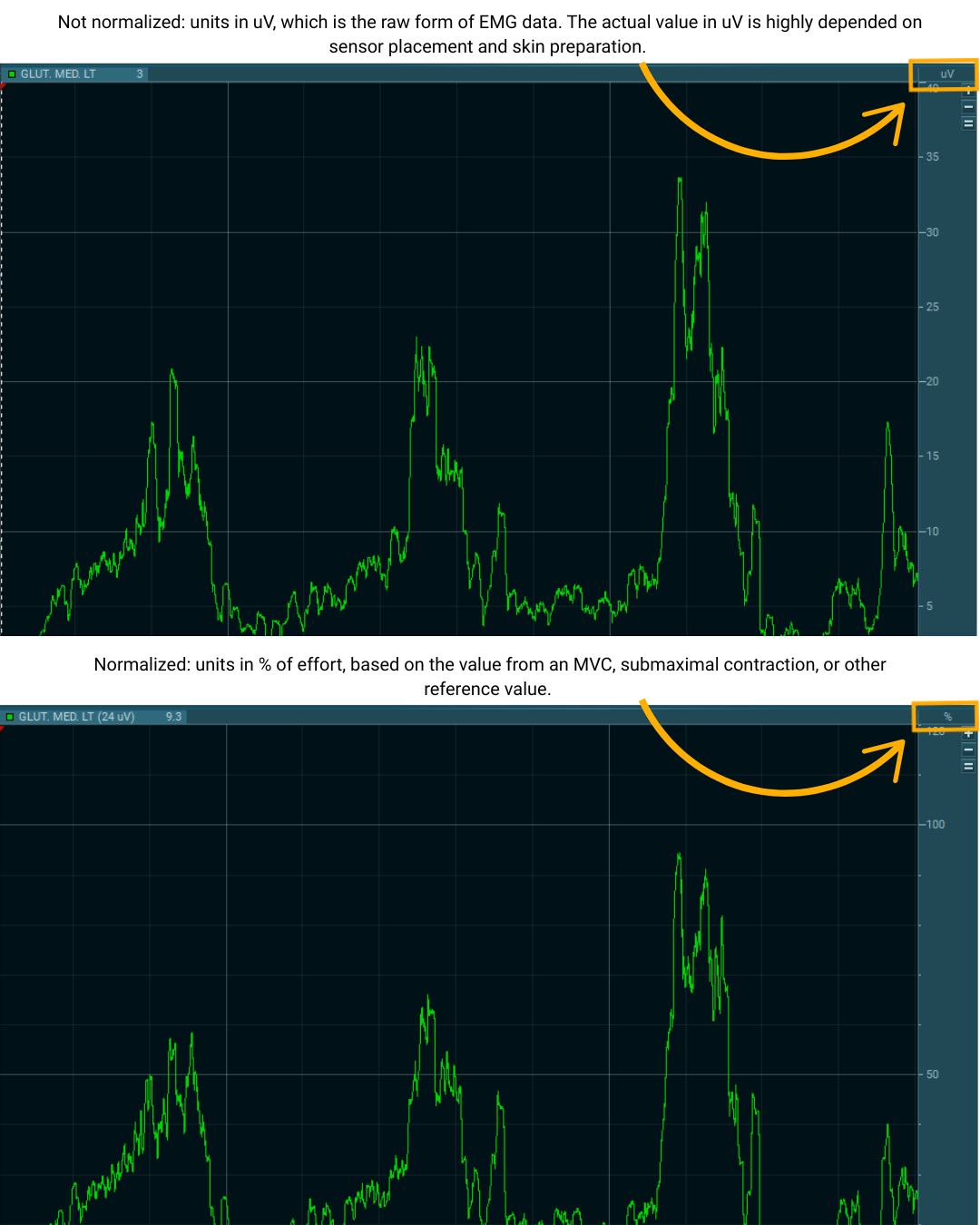 Side-by-side comparison of EMG signals before and after normalization. The top graph shows raw EMG data in microvolts (µV), with a label explaining that values depend on factors like sensor placement and skin prep. The bottom graph displays the same EMG signal normalized to a percentage of effort, referencing an MVC or submaximal contraction. Orange arrows highlight the unit change from µV to %, demonstrating how normalization allows for more meaningful comparisons across sessions or subjects.