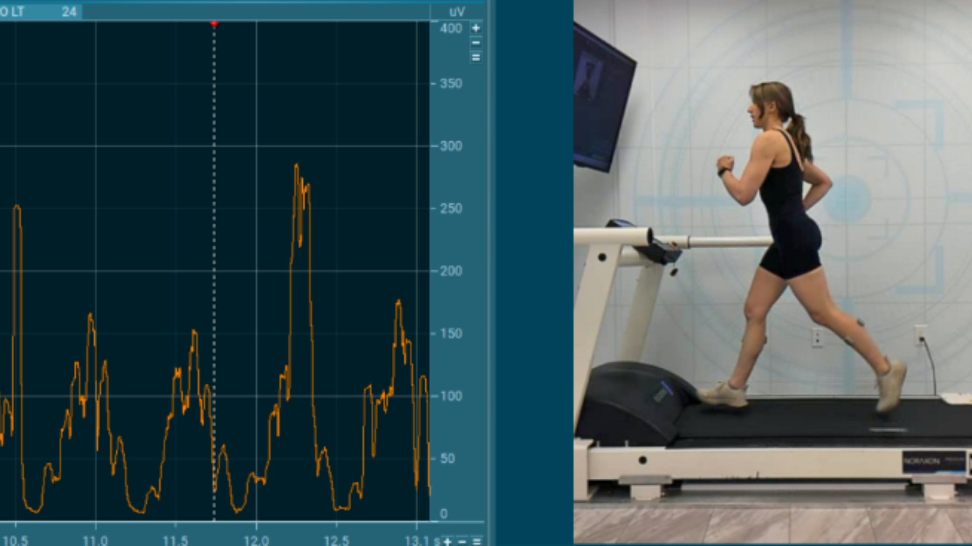 Split-screen image showing EMG data on the left and a treadmill running session on the right. The left side displays muscle activation from the left leg in orange, with rhythmic EMG signal peaks corresponding to stride cycles. The right side features a woman running on a treadmill in a lab setting, wearing EMG sensors on her legs, with a monitor in front of her displaying live data feedback.