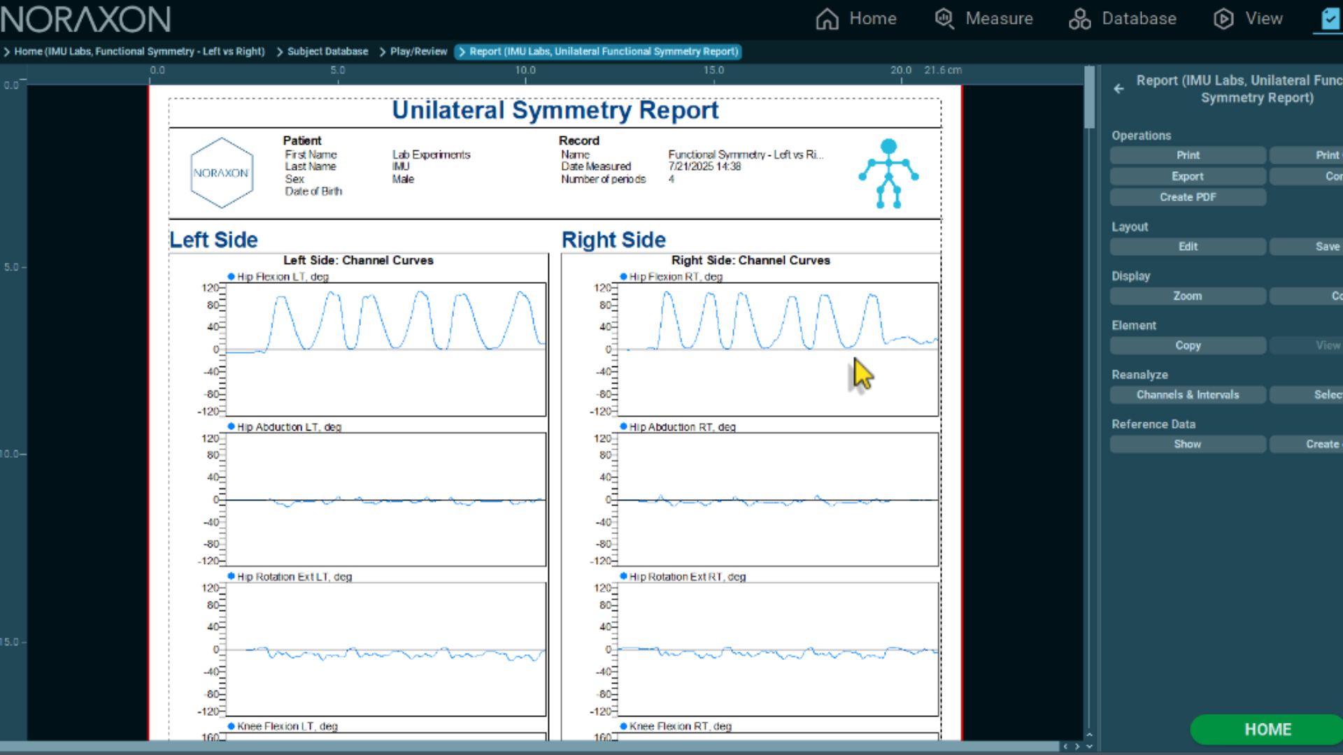 A screenshot of a Noraxon IMU Gait Lab Report displaying gait phase analysis. The report includes a series of illustrated walking figures showing the stance and swing phases, along with labeled events such as heel strike and toe-off. Below the visuals, a table lists gait phase parameters comparing left and right stance phases with percentage and variability data. The interface shows options for exporting, editing, and viewing reports within the Noraxon software.